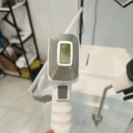 MÁY TRIỆT LÔNG DIODE DL05